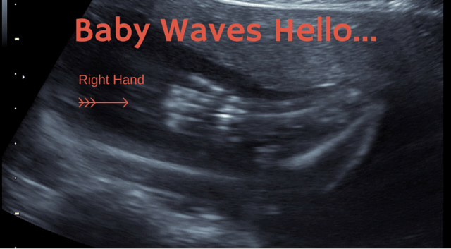 Baby Waves Hello