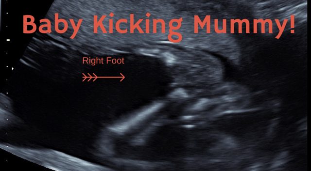 BABY KICKING